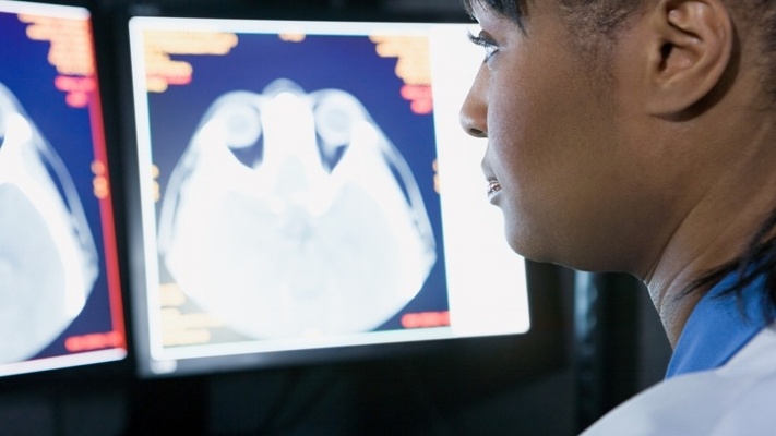 BrainscanonComputer.jpg BrainscanonComputer.jpg